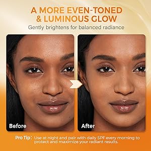QOOQ Turmeric Kojic Acid Soap for Dark Spots Brightening  Face and Body Wash with Vitamin C, Retinol, Collagen, Vitamin E, Glycerin, Shea Butter & Castile Olive Oil  Soap for Women & Men (120g x 2)
