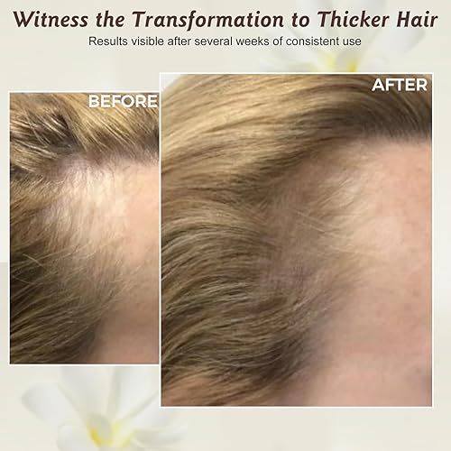 Miniatura 4 de Aceite de batana natural para el crecimiento y reparación del cabello, nutre el cuero cabelludo, fortalece el cabello, reduce las puntas abiertas,