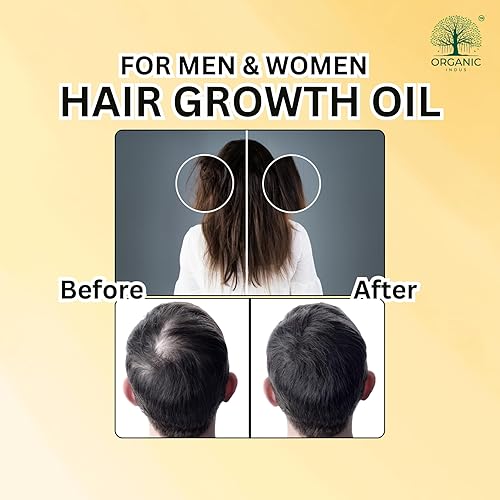 Miniatura 6 de Batana & Romero Aceite para el cabello para fortalecer el cuero cabelludo y el cabello, aceite de tratamiento, nutrición de cejas y pestañas