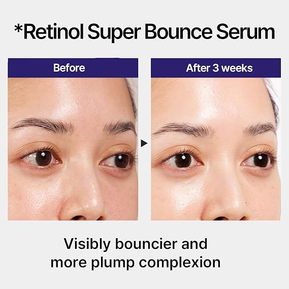 IOPE Retinol Super Bounce Serum 1.69 Fl Oz with Retinol Serum in Collagen Gel Mask 5+1 Set