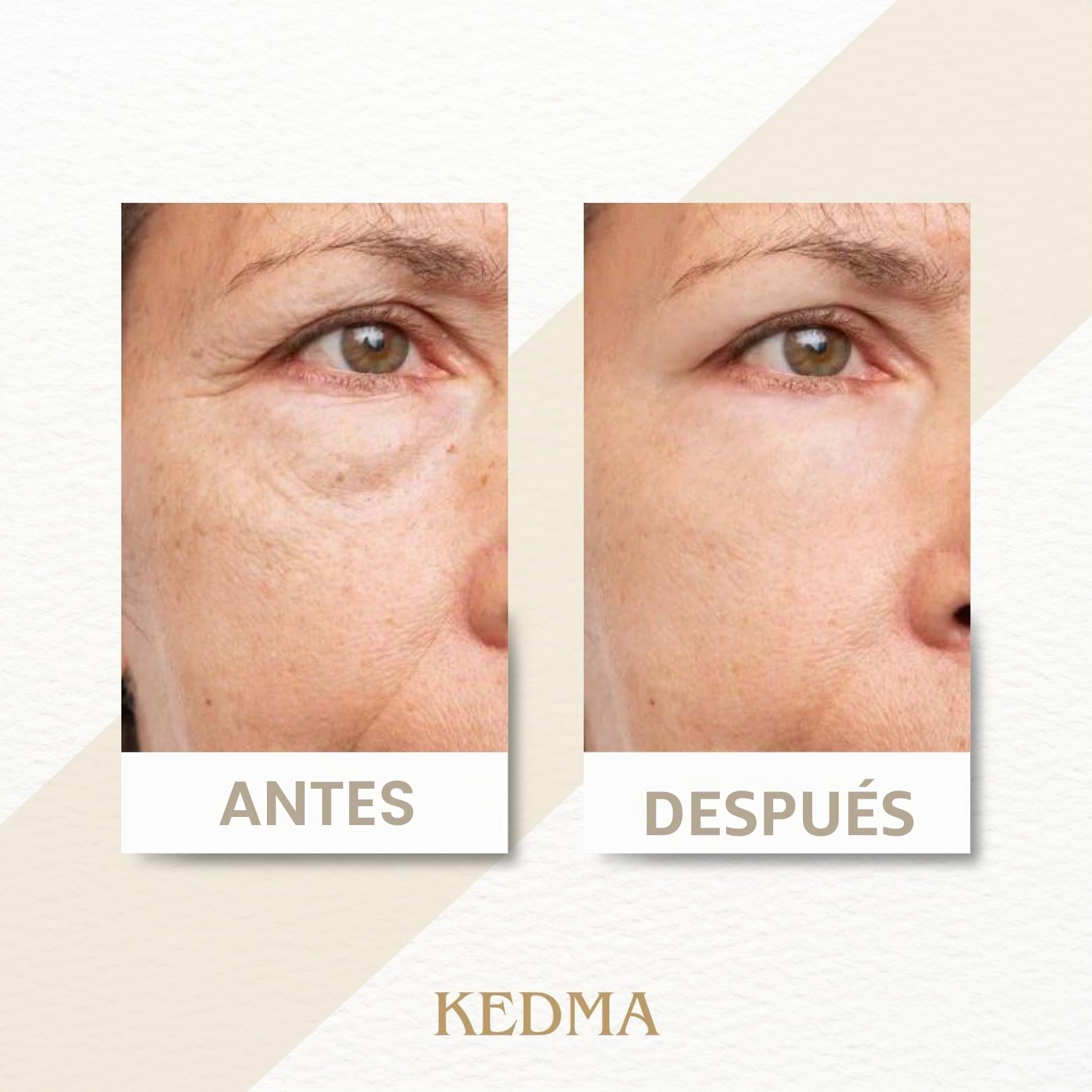 Kedma - Set Crème de Jour et de Nuit au Collagène et Minéraux de la Mer Morte - Hydratant et Anti-Âge - 2x50g | Las cremas de día y noche con colágeno hidratan la piel y acompañan la rutina de mañana y noche.