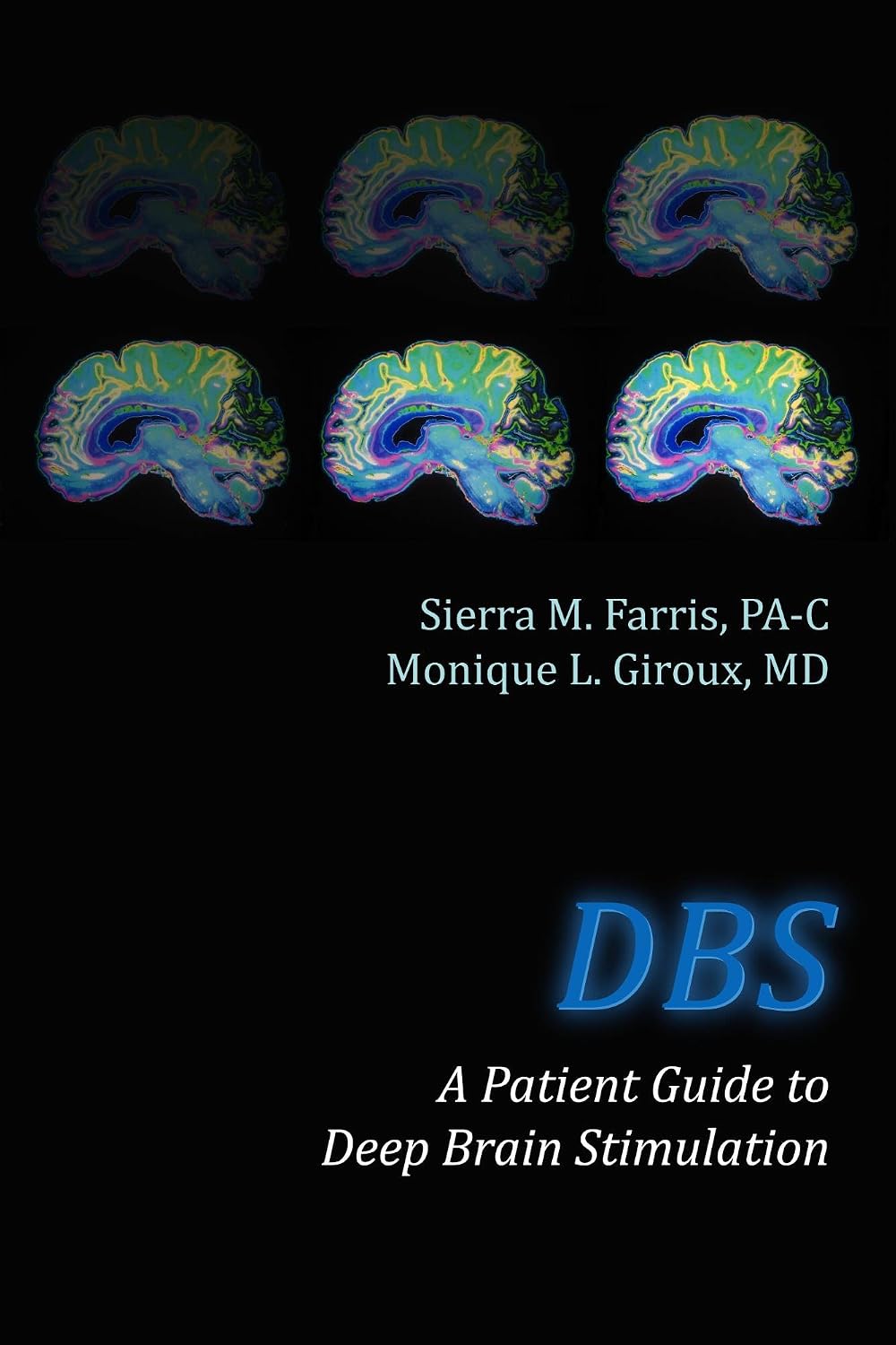 DBS A Patient Guide to Deep Brain Stimulation eBook : Giroux, Monique ...