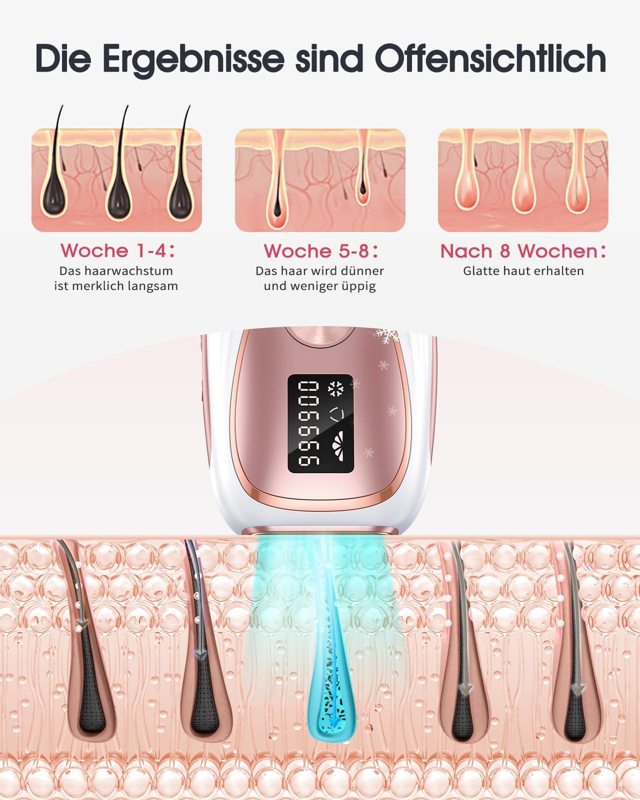 Haarlosy IPL Geräte Haarentfernung mit Kühlfunktion, 999,900 Lichtimpulse, 5 Energiestufen Schmerzfreie IPL Haarentfernung Laser Hair Removal für Frauen, Männer, Intimbereich, Körper und Beine - Rose