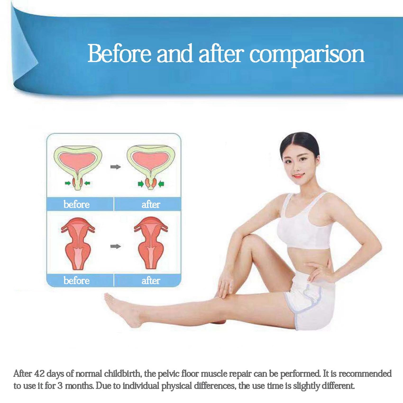 5X ÉLectrodes de Sonde Vaginale TENS/EMS Stimulateur Musculaire Du Plancher Pelvien EntraîNeur Exerciseur Femmes AméLiorent L'Incontinence