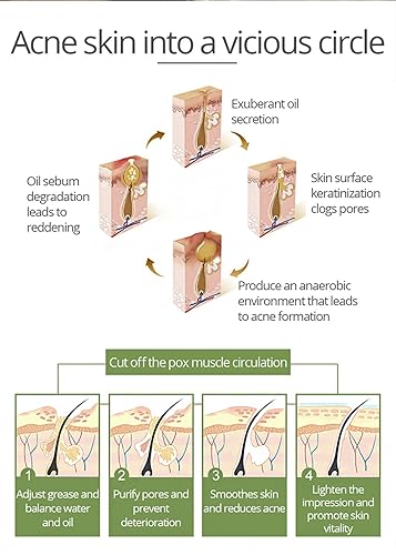 Miniatura 4 de Anti - ácido salicílico del extracto facial del aloe Vera del suero del acné repara la piel dañada 1.0fl oz