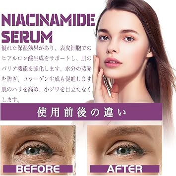 Iacinamide Beauty Serum, Highly Concentrated Essence, Moisturizing, Transparent, Glossy Skin Care, Serum 3