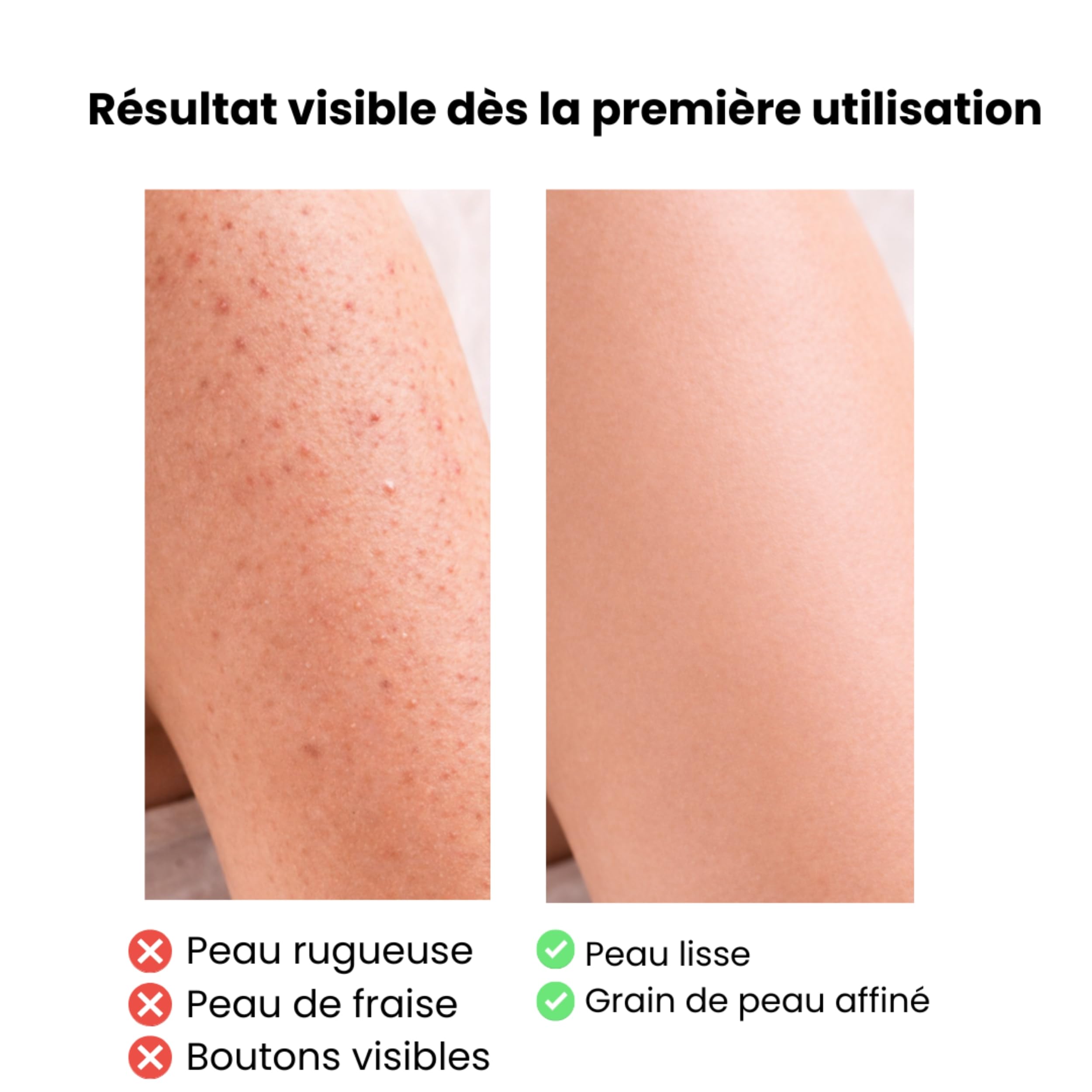 2 pcs x Gants exfoliants Visage et Corps, gant de Kessa/Crin/Viscose peaux mortes, gommage en profondeur tout en douceur, nettoie et élimine cellules mortes, peau d'orange, cellulaire, taches