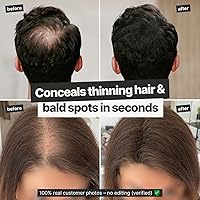 Vista 3 de IMPERIO Fibras de construcción del cabello para adelgazar el cabello, 0.86 onzas de fibras de pelo de alta calidad para mujeres y hombres en calidad