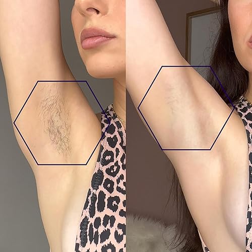 Miniatura 6 de MICHAEL TODD Beauty - LUMOS - Depilación láser IPL para mujeres y hombres, tecnología CoolMax de 50 F, 999.999 flashes, 3 en 1 con sensor de piel