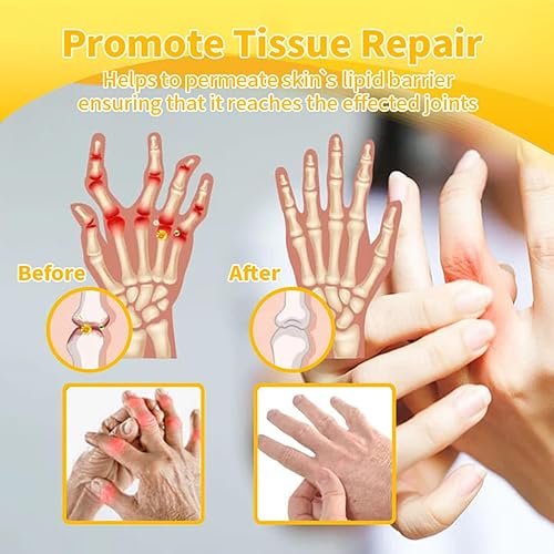 Miniatura 5 de Toxina Botulínica y Veneno de Abeja Alivio del Dolor Crema Curativa de Hueso, Crema de Veneno de Abeja, Mejora eficazmente la movilidad de las