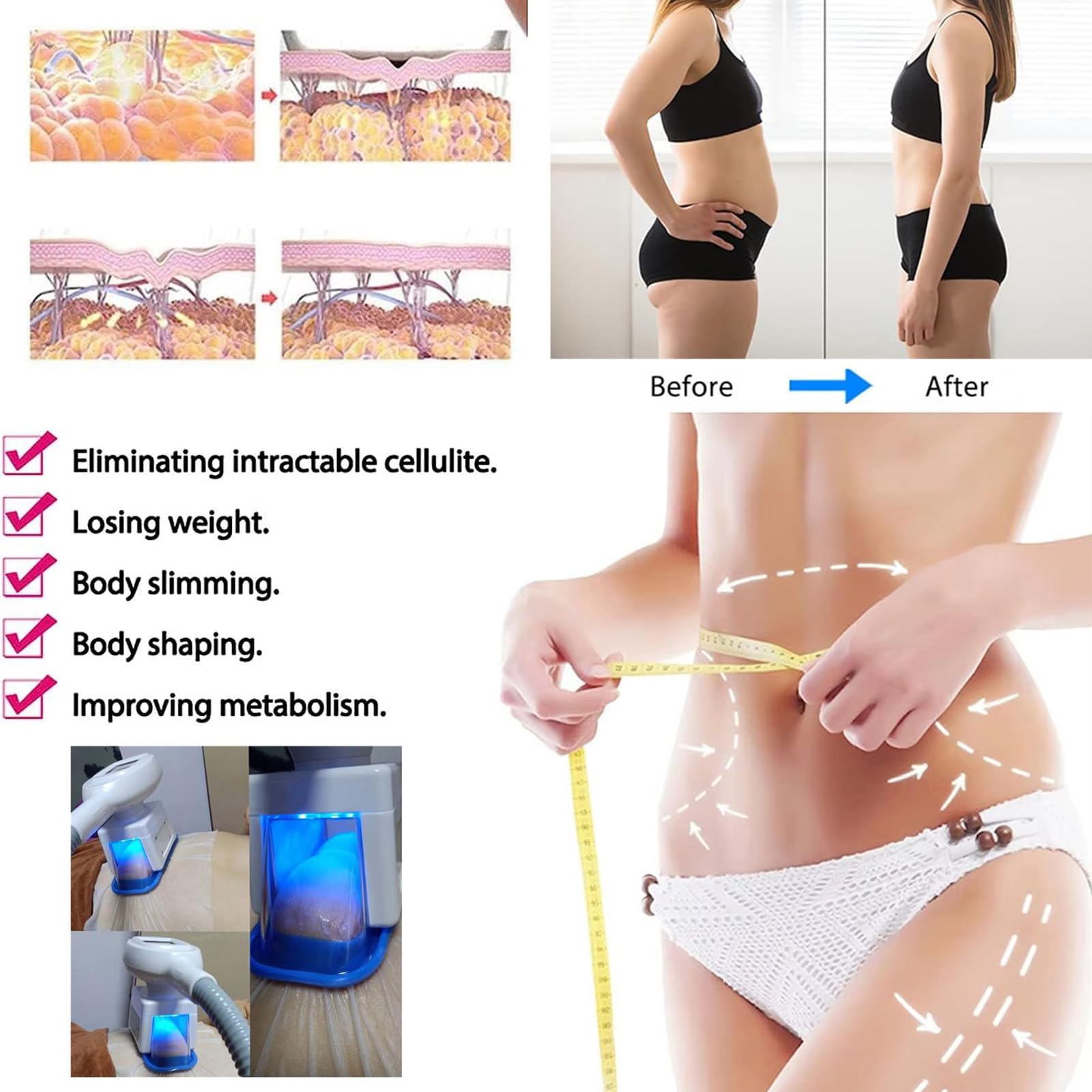 Dispositivo per Modellamento del Corpo, Dimagrimento E Lipolisi, Macchina per Congelamento del Grasso, Crioterapia a 360° Macchina, Massaggiatore per La Rimozione della Cellulite