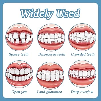 Belligern 4 Pairs Clip in Veneers Teeth, Press up and Down Veneers Teeth Comfort Teeth Veneers, False Teeth Set with Box Regain Your Confident Smile for Men and Women