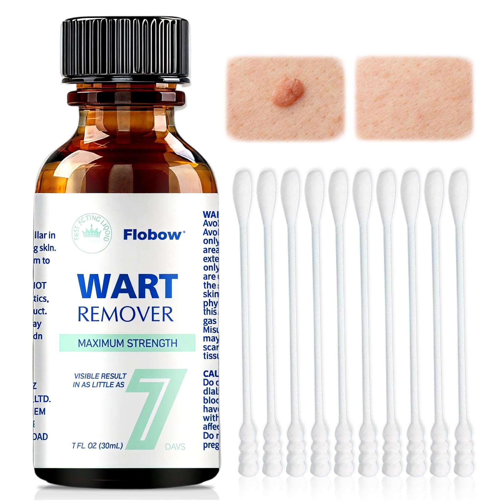 Líquido exfoliante para el cuidado de la piel 30 ml, para verrugas, mejora la textura de piel áspera y protuberancias cutáneas, uso en cara, cuello, manos y pies