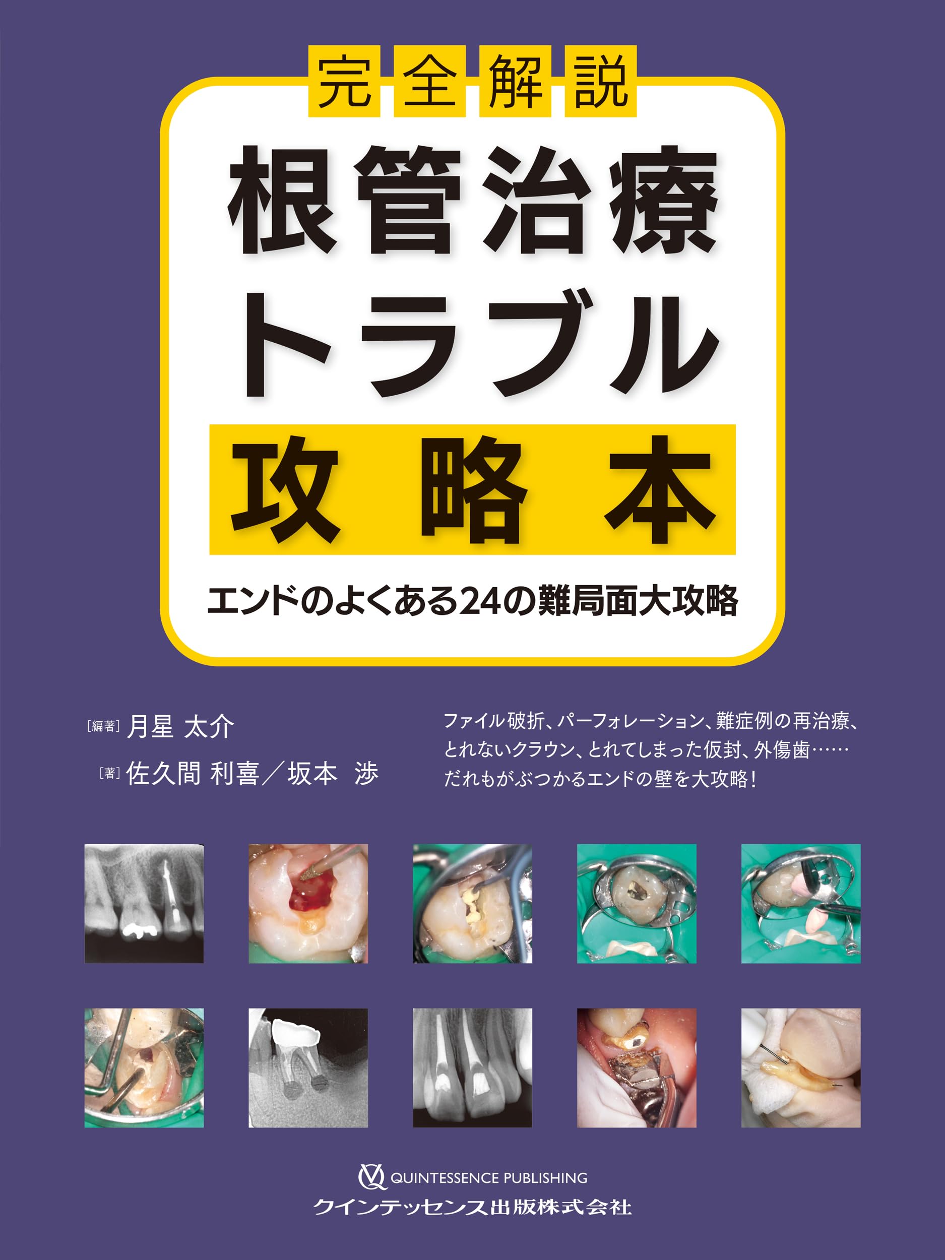 完全解説 根管治療トラブル攻略本 : エンドのよくある24の難局面大攻略 完全解説 根管治療トラブル攻略本: エンドのよくある24の難局面大攻略