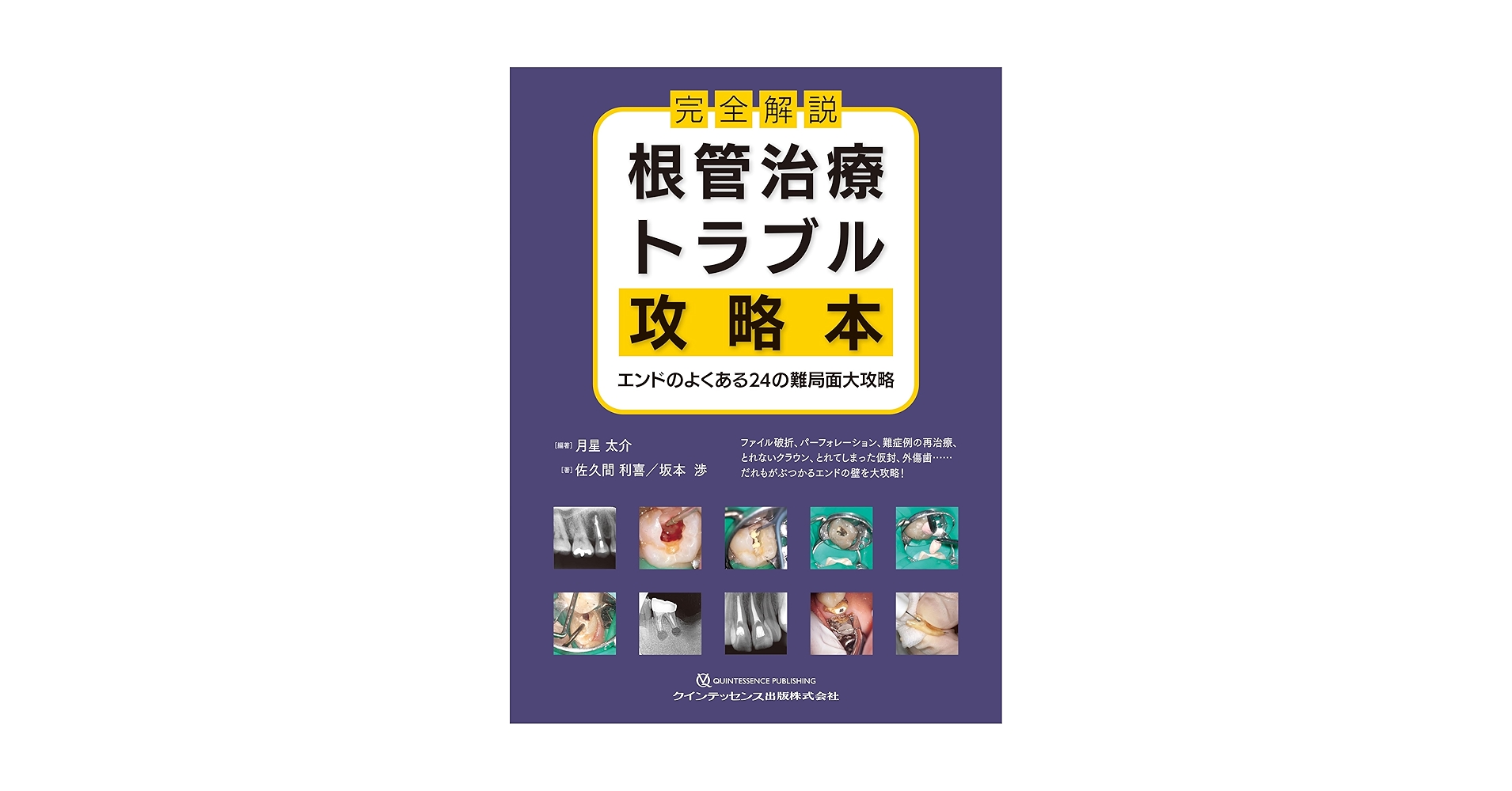 完全解説 根管治療トラブル攻略本: エンドのよくある24の難局面