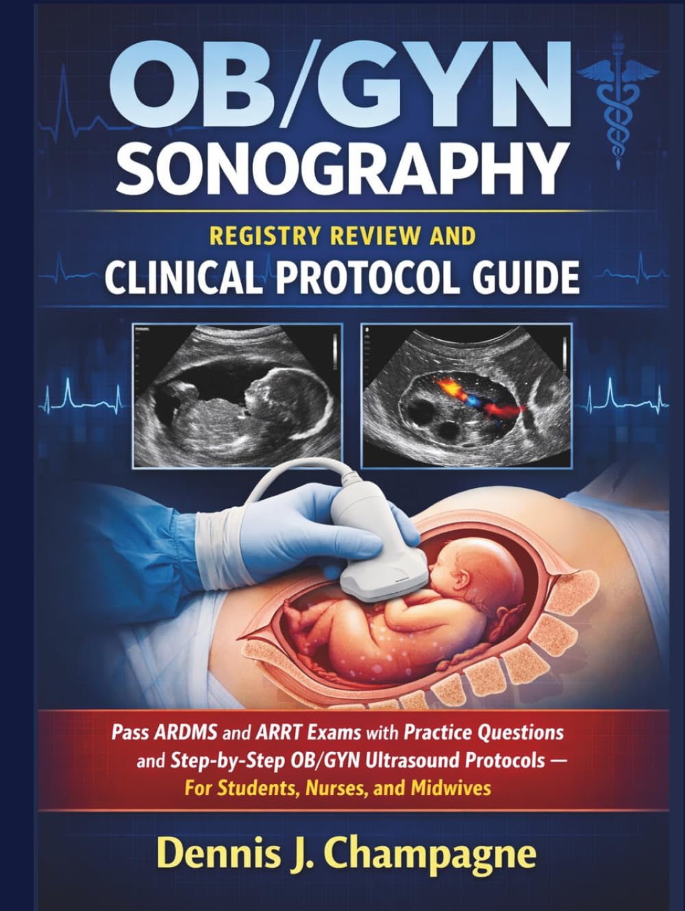OB/GYN Sonography Registry Review and Clinical Protocol Guide: Pass ARDMS and ARRT Exams with Practice Questions and Step-by-Step OB/GYN Ultrasound ... Nurses, and Midwives (medical books)