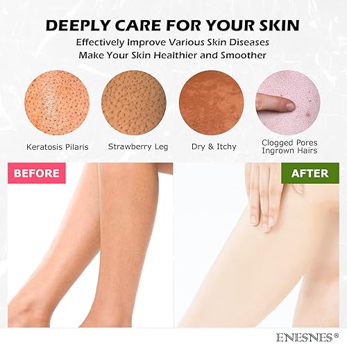 Miniatura 3 de ENESNES - Guante exfoliante grueso, 2 unidades de exfoliante corporal para ducha, guante exfoliante coreano, removedor especial de piel muerta y