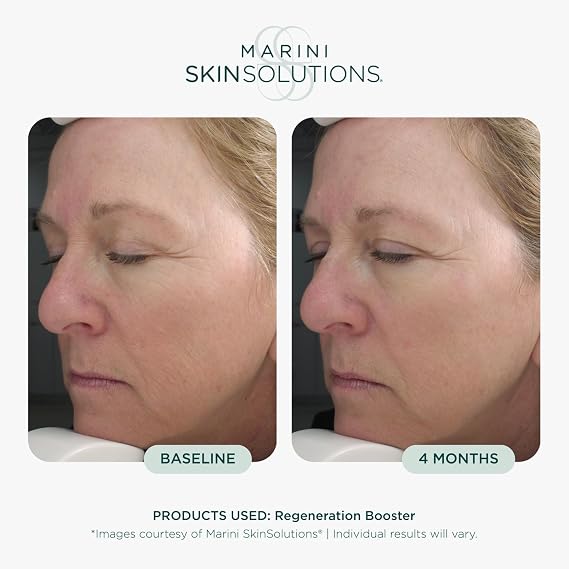 Marini SkinSolutions Regeneration Booster - Anti-Aging Face Lotion - Peptides, Growth Factors & Antioxidants for Wrinkles, Texture, Pores & Hydration - Cruelty Free - Made in the USA - 1 fl oz