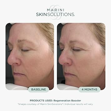 Marini SkinSolutions Regeneration Booster - Anti-Aging Face Lotion - Peptides, Growth Factors & Antioxidants for Wrinkles, Texture, Pores & Hydration - Cruelty Free - Made in the USA - 1 fl oz