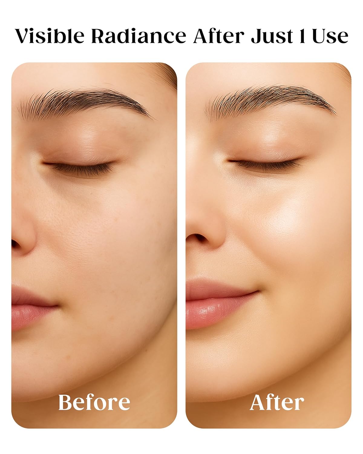 Kaplan MD Clarifying Toner – Hydrating Face Mist with Hyaluronic Acid, Rosewater Face Mist Hydrating Spray & Witch Hazel – Facial Toner Spray for Pore Refining, pH Balance & All Skin Types – 3.4 fl oz