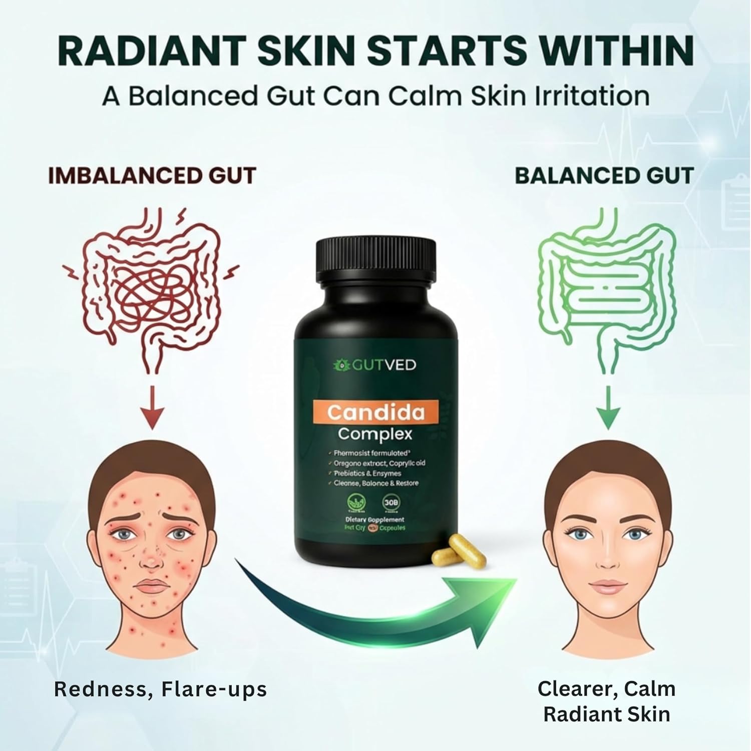 Candida Complex with Caprylic Acid for Men & Women – Anti Overgrowth, Balance and Restore Supplement for Yeast, Healthy Gut Flora & Skin with 30B/g Probiotic, Oregano, Senna - 1 Month Supply - Image 4