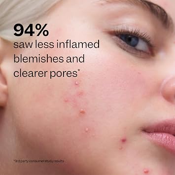 Peach Slices - Acne Clarifying Cleanser (4.05 oz) - 2% Salicylic Acid Acne Treatment - Clear & Prevent Breakouts, Hydrate - Cucumber, Cica, Acerola - Vegan, Cruelty Free, Korean Skin Care & Beauty