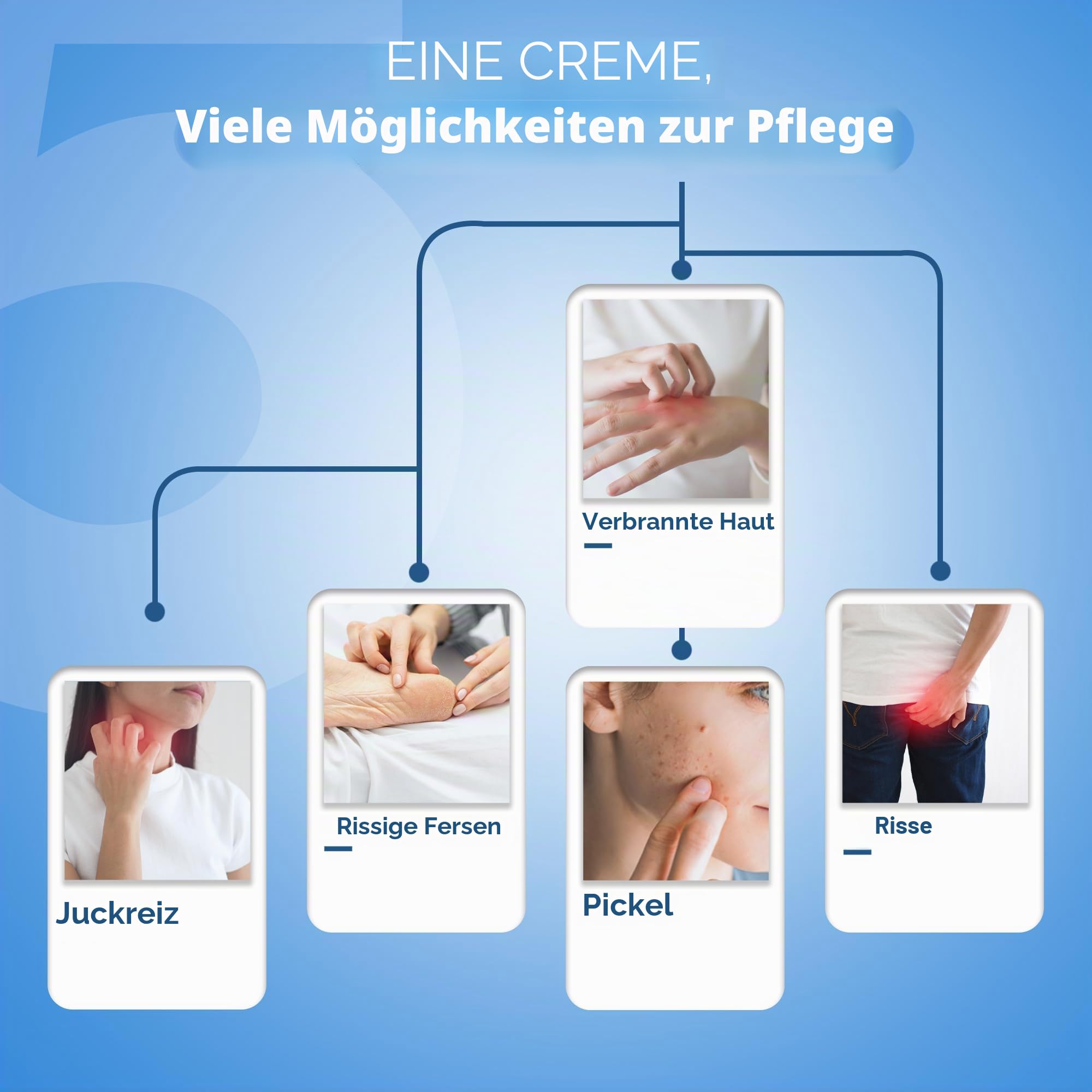 Kailas Jeevan Ayurvedische Kräutercreme, vielseitig einsetzbar (kleinere Verletzungen, Schnitte, Hitzepickel, rissige Fersen), 230 g, große Sparpackung