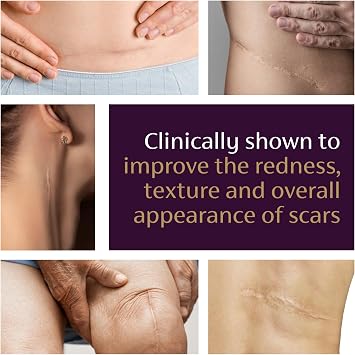 Mederma Advanced Scar Gel, Cepalin Scar Treatment, Old and New Scars, 50g