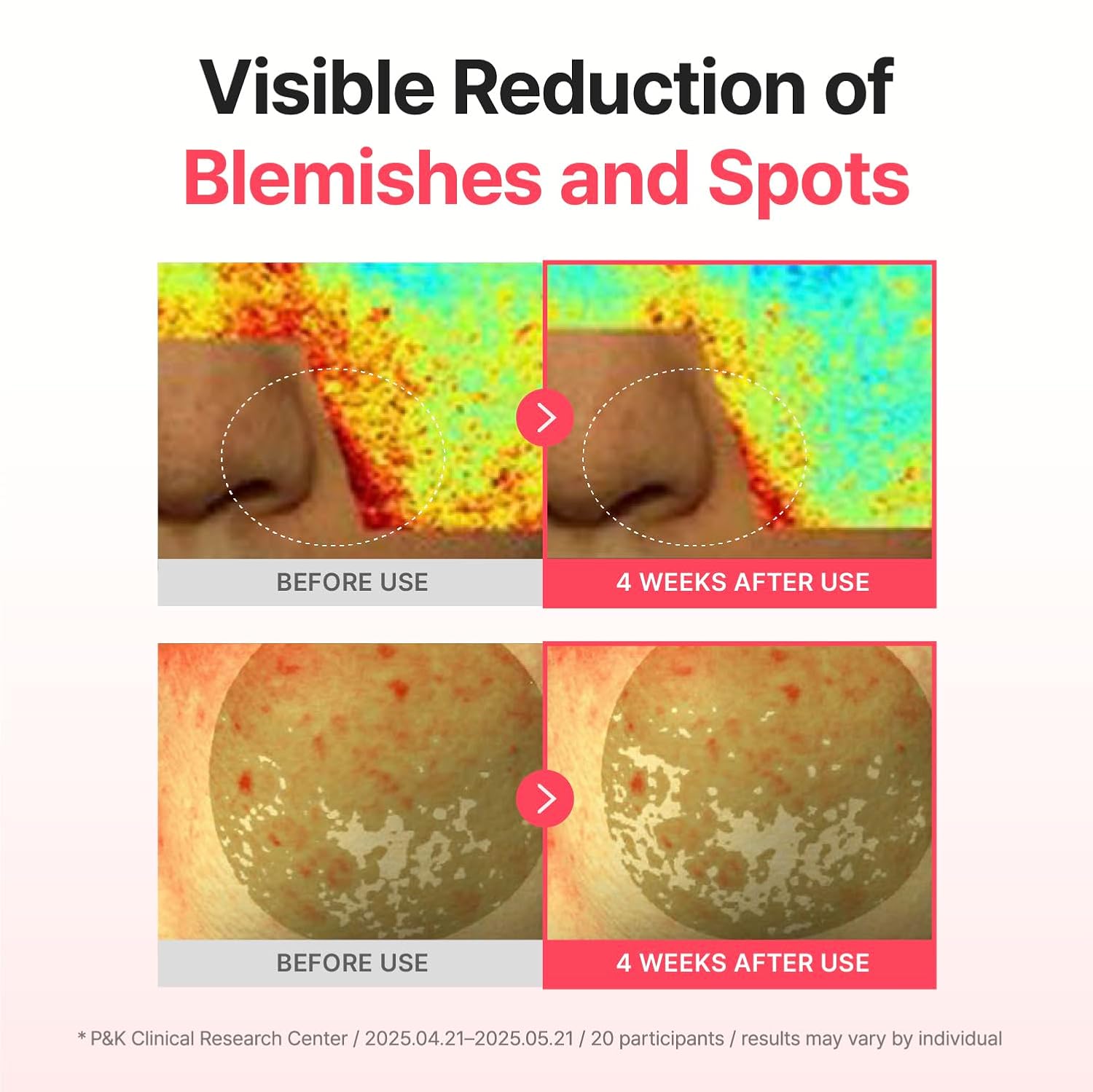 CENTELLIAN 24 Expert Serum (Season 3 (0.33fl oz x 1pc) - Korean Serum for Face Soothing & Even Tone for Men Women Dry and Sensitive Skin Blemish correcting ampoule Intensive Barrier Care by Dongkook - Image 4