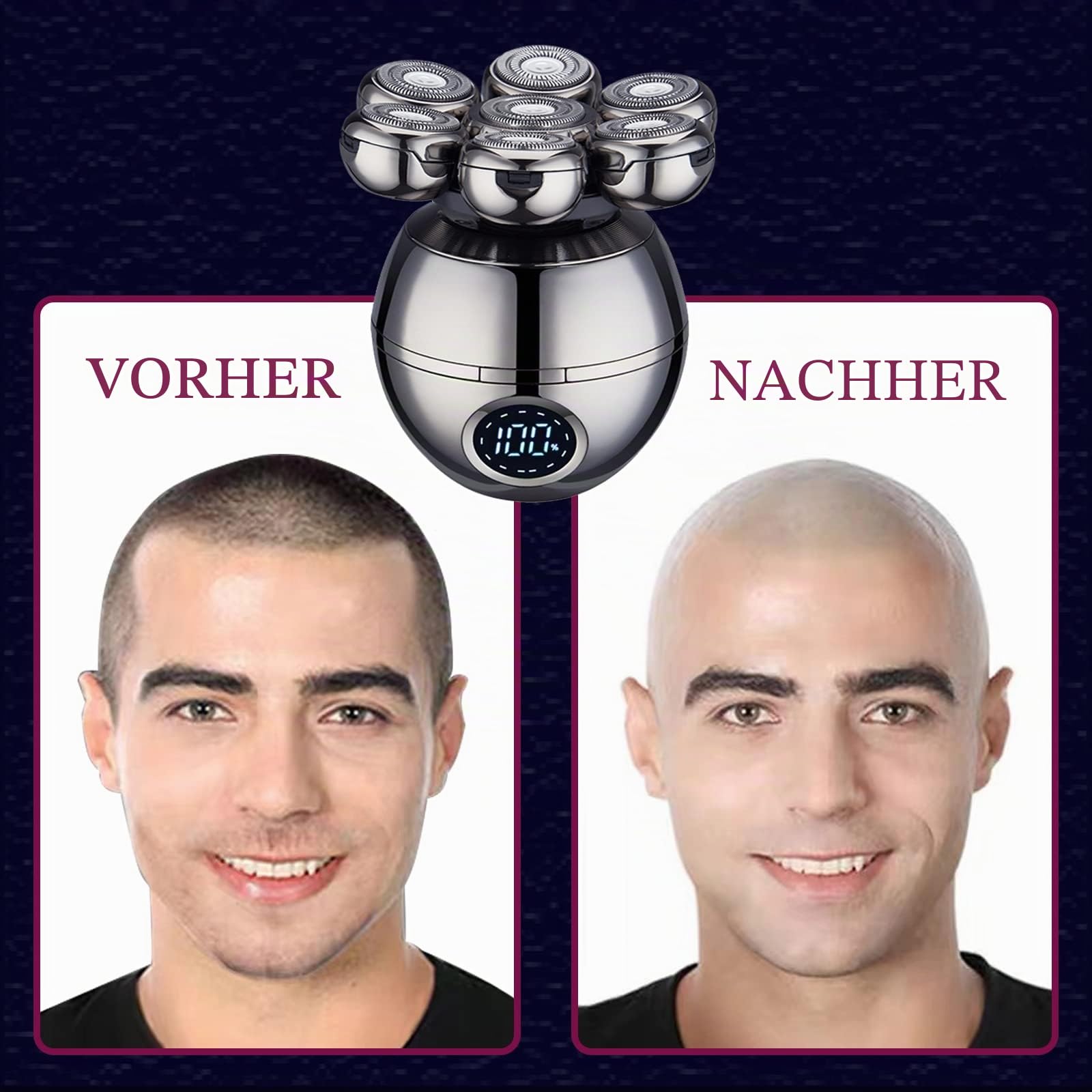 Kopfrasierer für Männer, 2 Scherköpfe, Anti-Pinch-Nass- und Trocken-Elektrorasierer mit kabelloser Ladebasis, Trimpod 3.0, der ultimative Rasierer für Männer, Frauen, und Glatze, Gesicht, Bein, Körper