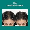 Women's Hair Care Complex | Supports Hair Growth & Thicker Stronger Hair