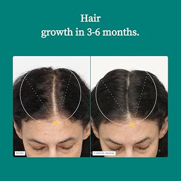 Women's Hair Care Complex | Supports Hair Growth & Thicker Stronger Hair