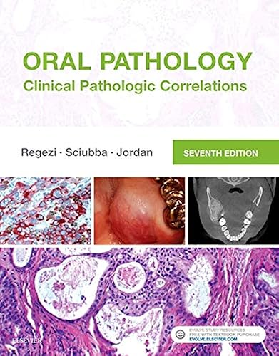 Oral Pathology: Clinical Pathologic Correlations