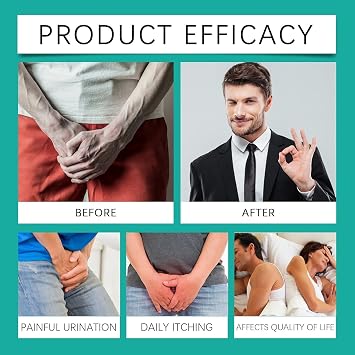 Prostate Relief Cream,Prostate T_reatment Cream,Prostate Cream, Prostate Care Cream, Prostate Enhance Cream for Men (2 pcs)