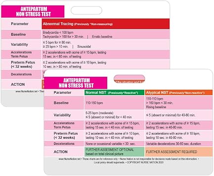 Antepartum Non Stress Test Reference Horizontal Badge Card - Excellent Resource for Nurses, Nursing Clinicals, and RN Students - Great Nursing School Supplies and Accessories
