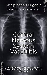 Vasculopathy : A Comprehensive Exploration of Central Nervous System Vasculitis