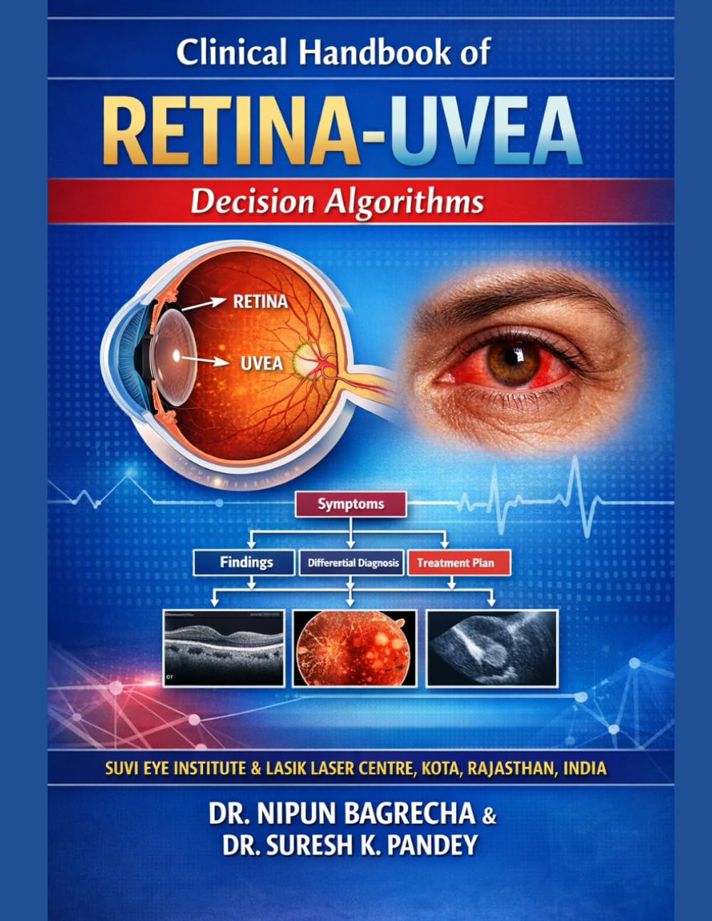 Clinical Handbook of Retina-Uvea Decision Algorithms