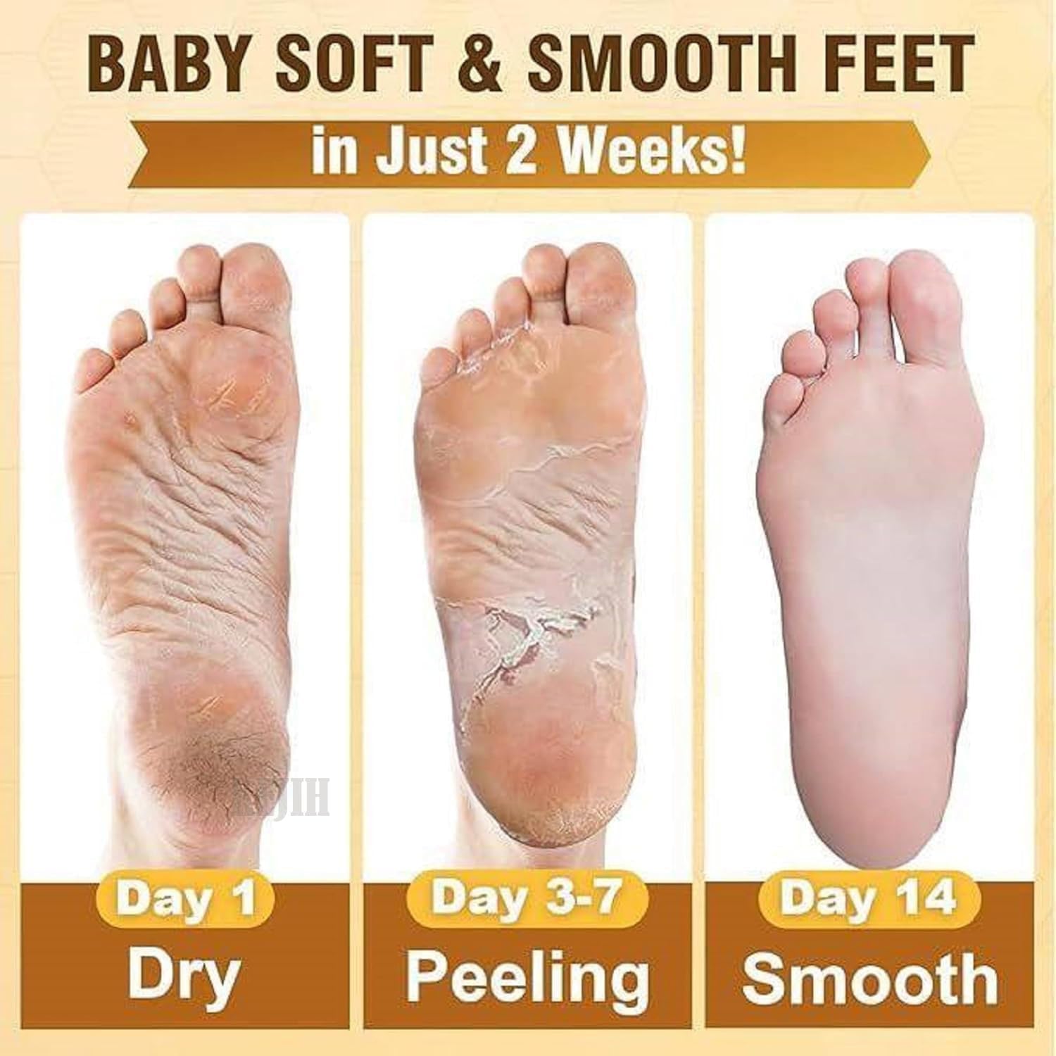 ELUYANI Foot Peeling Mask for Dead Skin Removal β Natural Exfoliating Foot Mask for Dry Feet, Calluses & Cracked Heels (levender foot mask) (PACK OF 2) 2