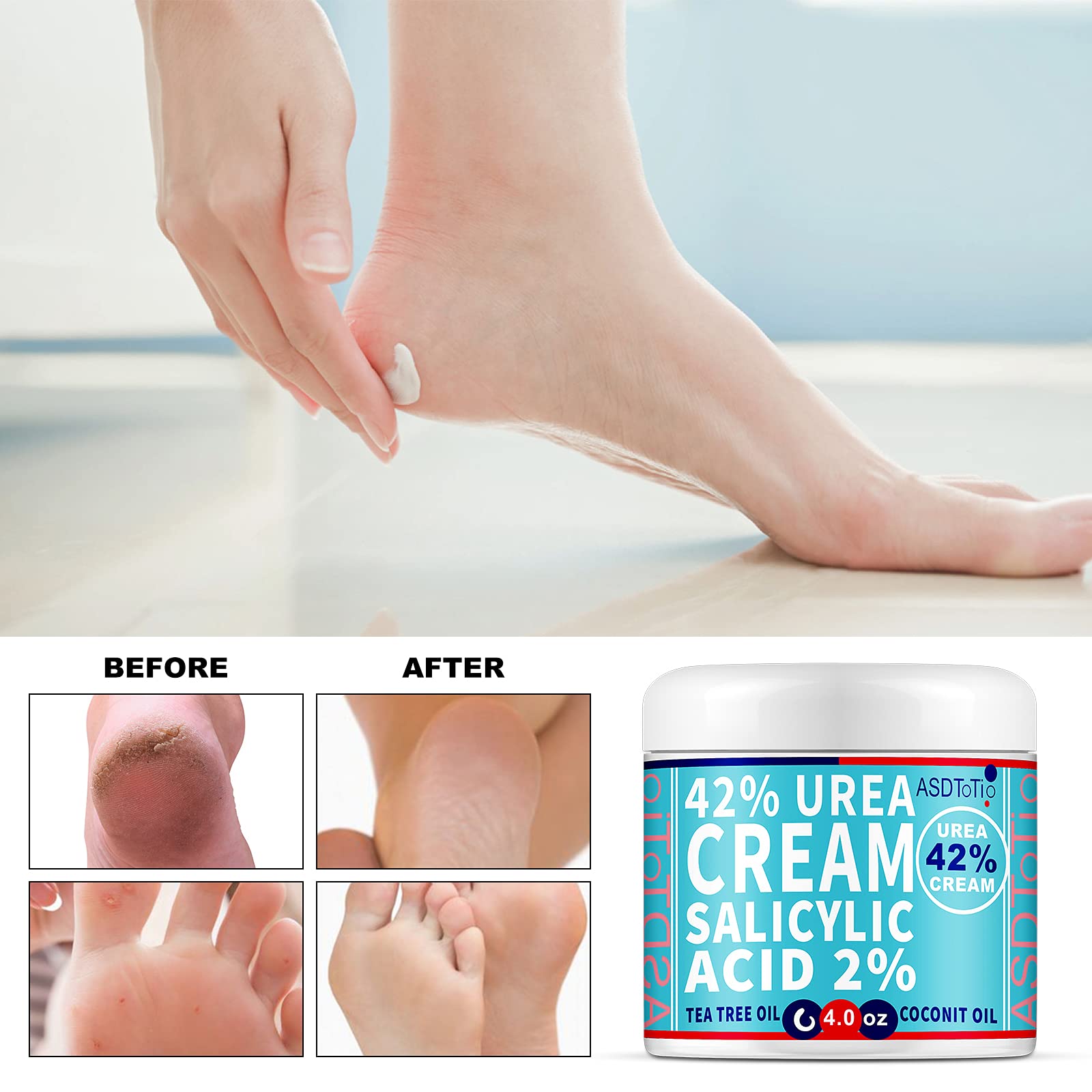 Urea 42 Foot Cream Plus Salicylic Acid 4 Oz Moisturizes and