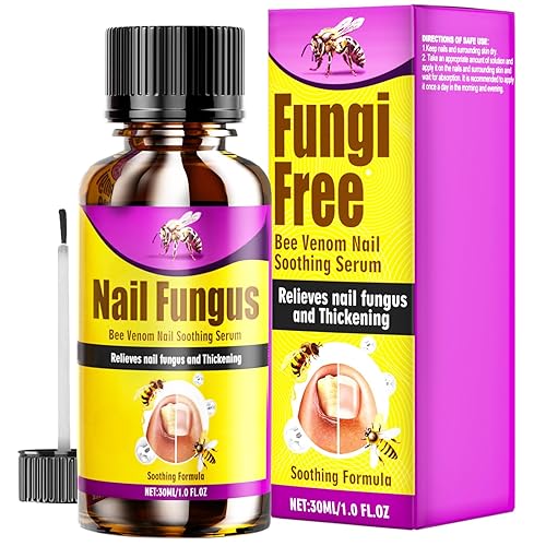 Tratamiento de hongos en las uñas de los pies extra fuerte, tratamiento de hongos en las uñas del pie, tratamiento de hongos de hongos en las uñas,