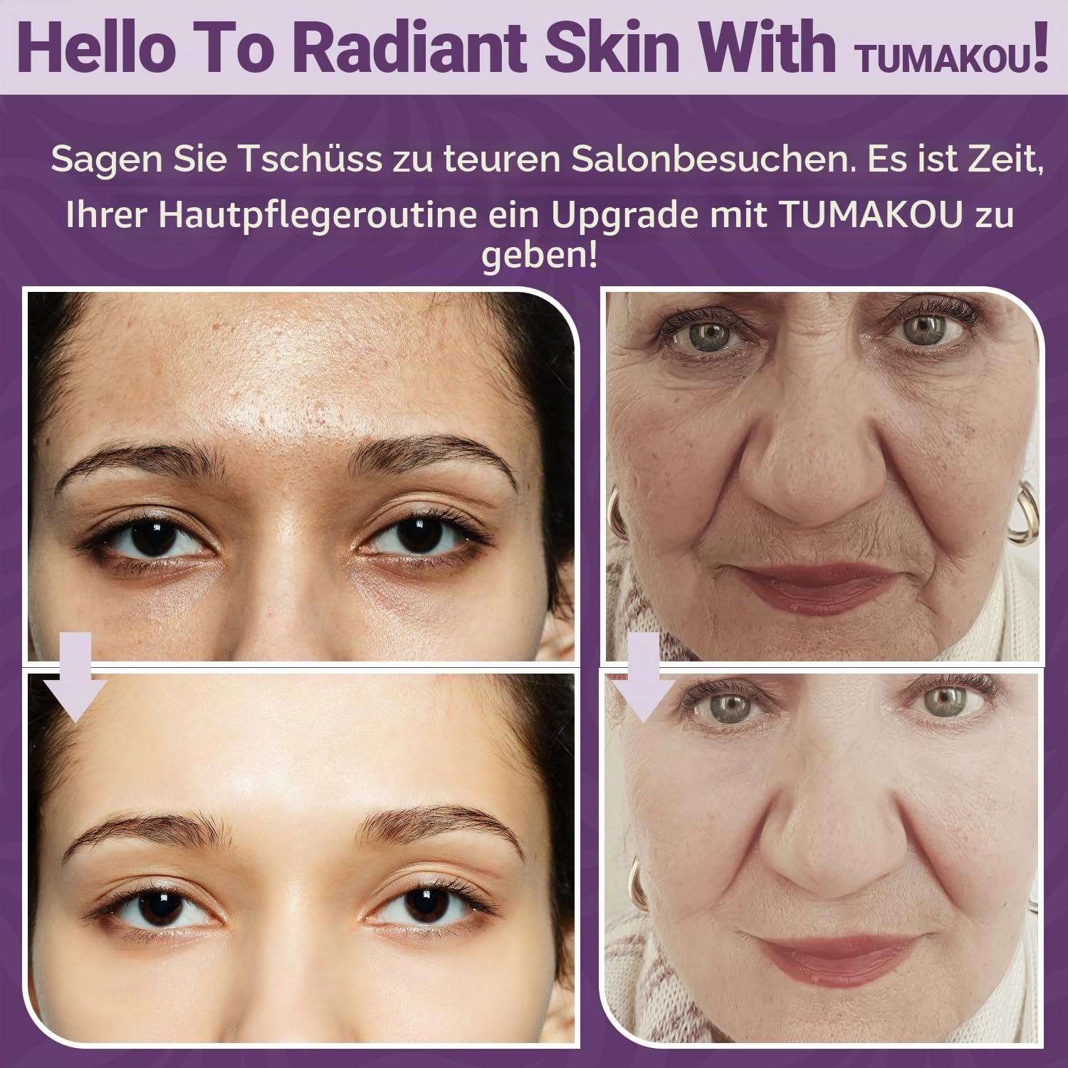 Radiofrequenz Gerät Gesicht - TUMAKOU 4 in 1 EMS Microcurrent Facial Device | Blau Red Light Therapy Face - Mikrostrom Gerät Gesicht- Gesichtsmassagegerät Gegen Falten für Anti-Aging,Face Lifting