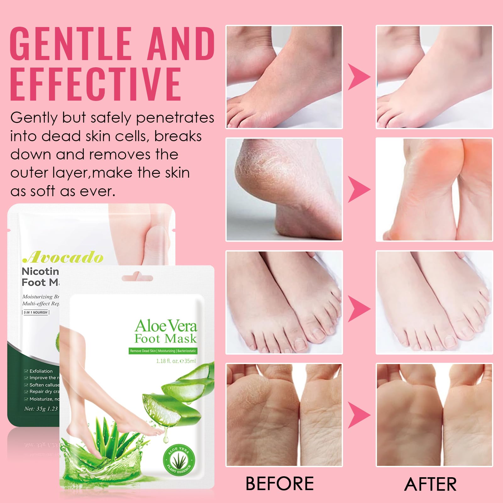 2 Paires Masque Pieds Peeling Exfoliant, Masque Peeling Pieds, Masque Hydratant Pieds Pour Callosités, Crevasses et Pieds Secs, Soin Pied et Callus Peeling Pieds Femmes & Hommes (Aloe Vera + Avocat)