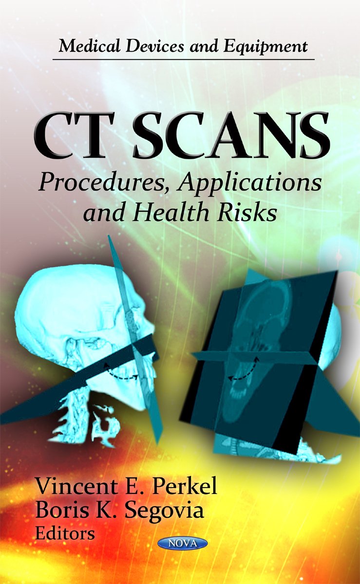 Ct Scans: Risks – Ct Scans And Cancer – UFFEZ