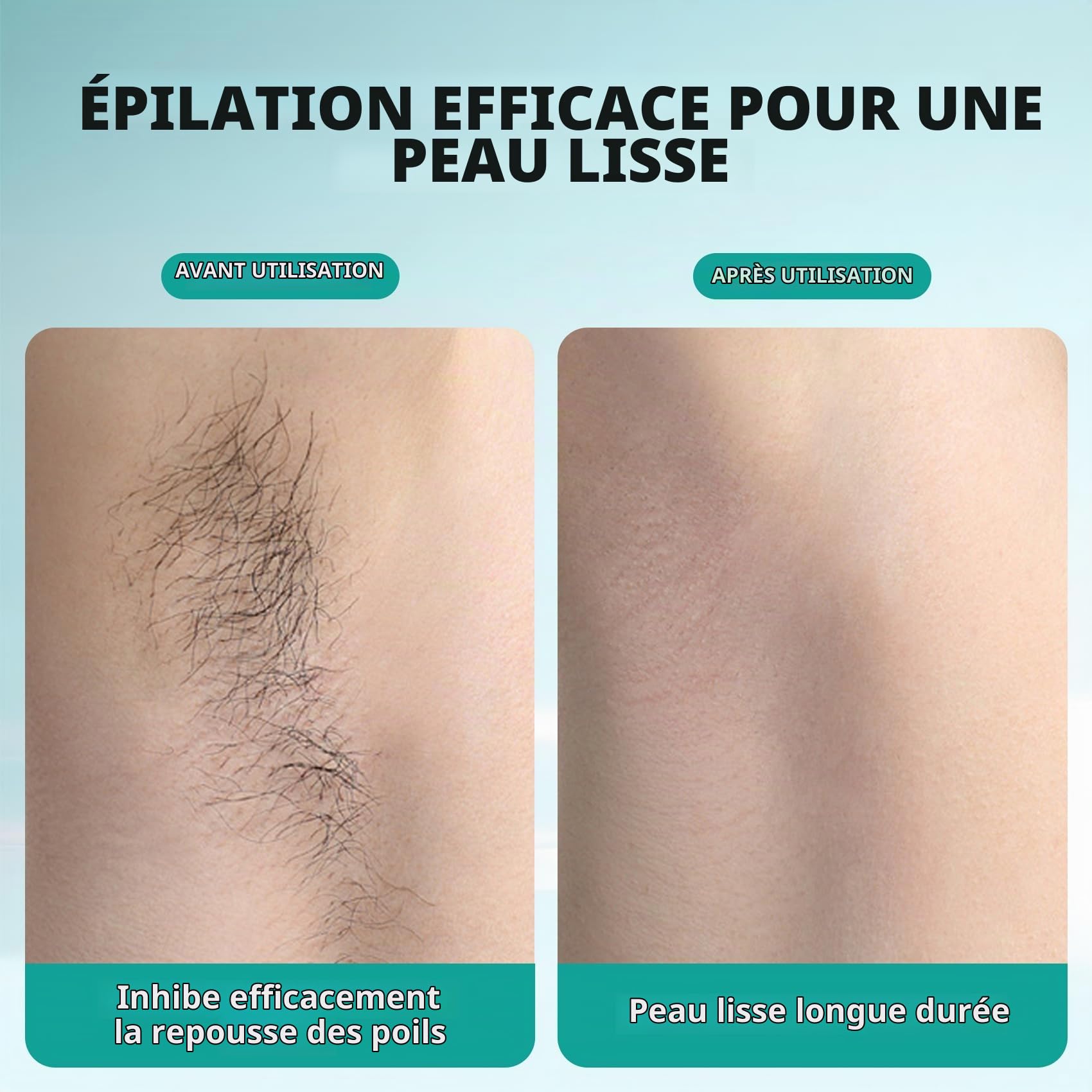 Epilateur Lumiere Pulsee avec Refroidissement, 10 °C et large tension 100 V-240 V, Épilation Laser Définitive, et Indolore pour Visage, Corps, Maillot, Aisselles, Camping Car, Voyages Internationaux