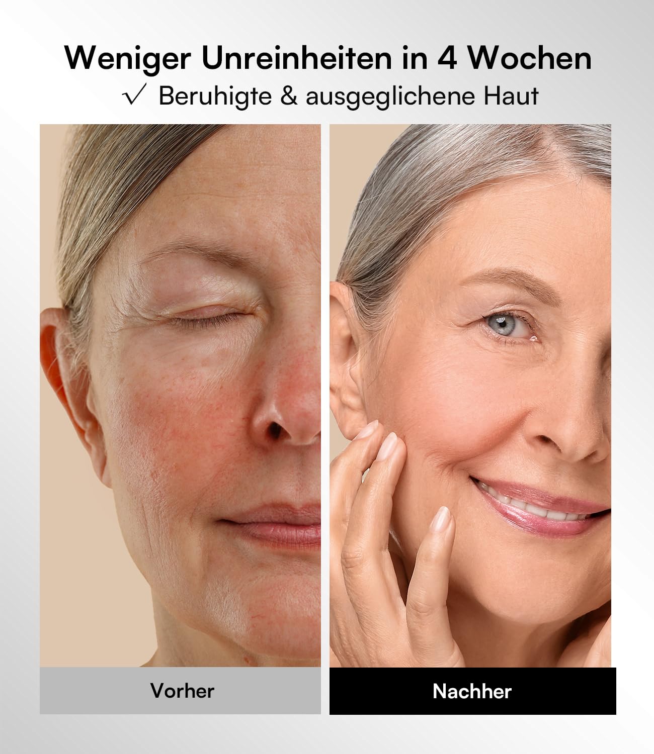 INIA LED Gesichtsmaske Lichttherapie 4 Modi 850nm NIR Rote Blaue 220 Perlen Red Light Therapy Face Mask Aufladbar 2600mAh Anti-Aging