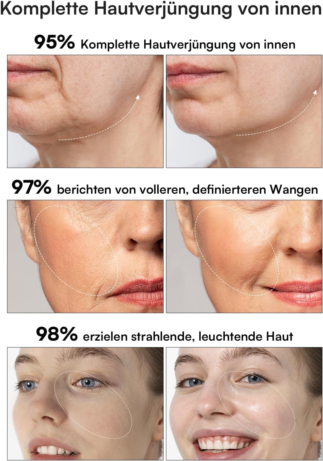 INIA Professionelles 3-in-1 Anti-Falten Gesichtsmassagegerät mit Mikrostrom & Rotlicht Straffendes Lifting-Gerät für Gescht/Hals, Reduziert Schwellungen & Falten Firm