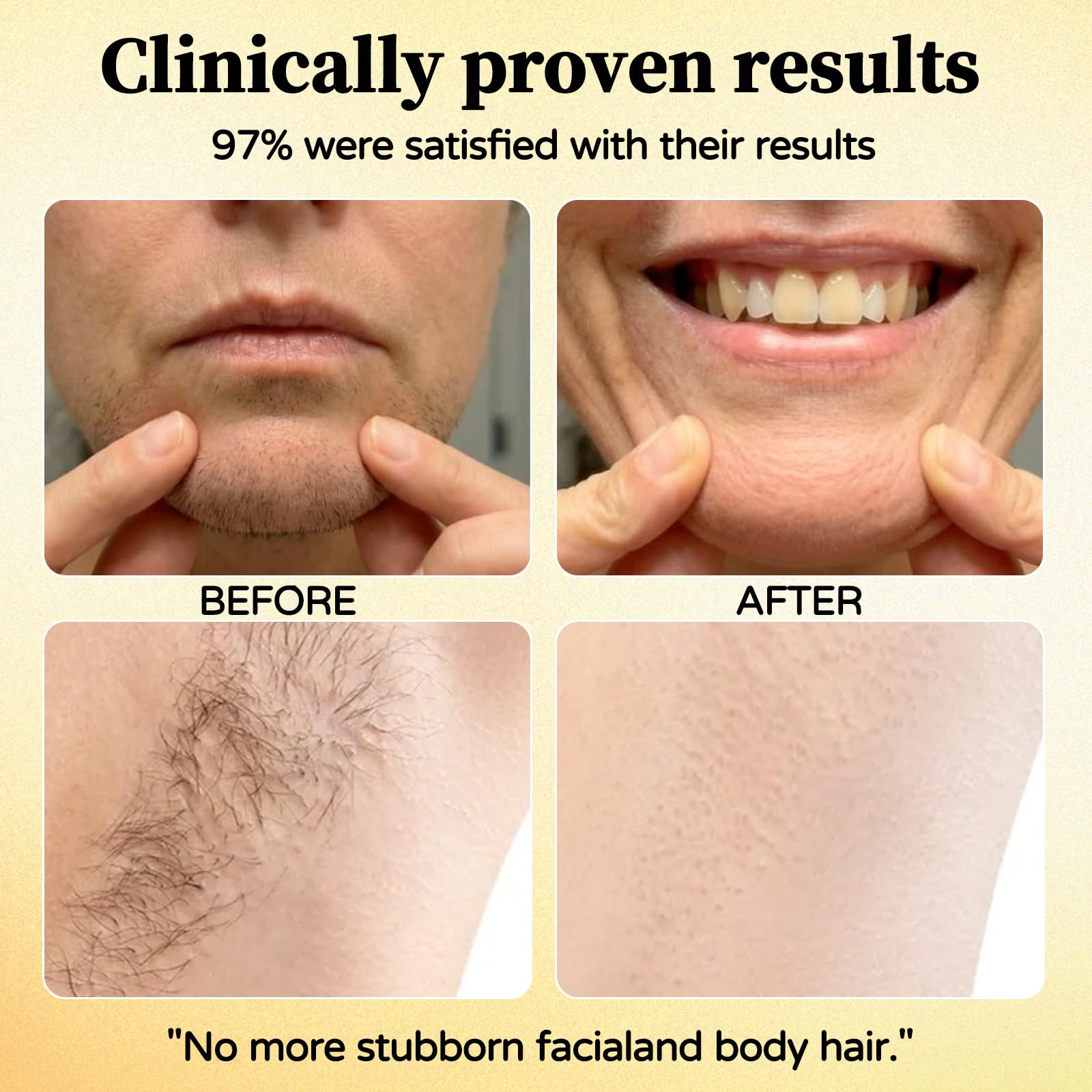 Renovia Cyperus Rotundus Oil for Hair Removal, 2026 New Renovia Cyperus Rotundus Skin Serum, Pore Minimizer, Moisturizing & Soothing, Natural Herbal Hair Removal Oil for All Skin Types (1 Bottle) - 3