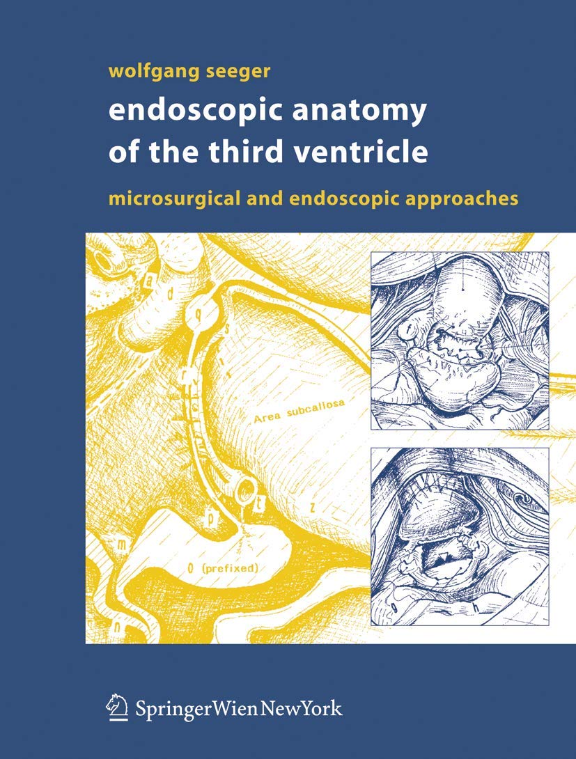 Endoscopic Anatomy of the Third Ventricle: Microsurgical and Endoscopic Approaches