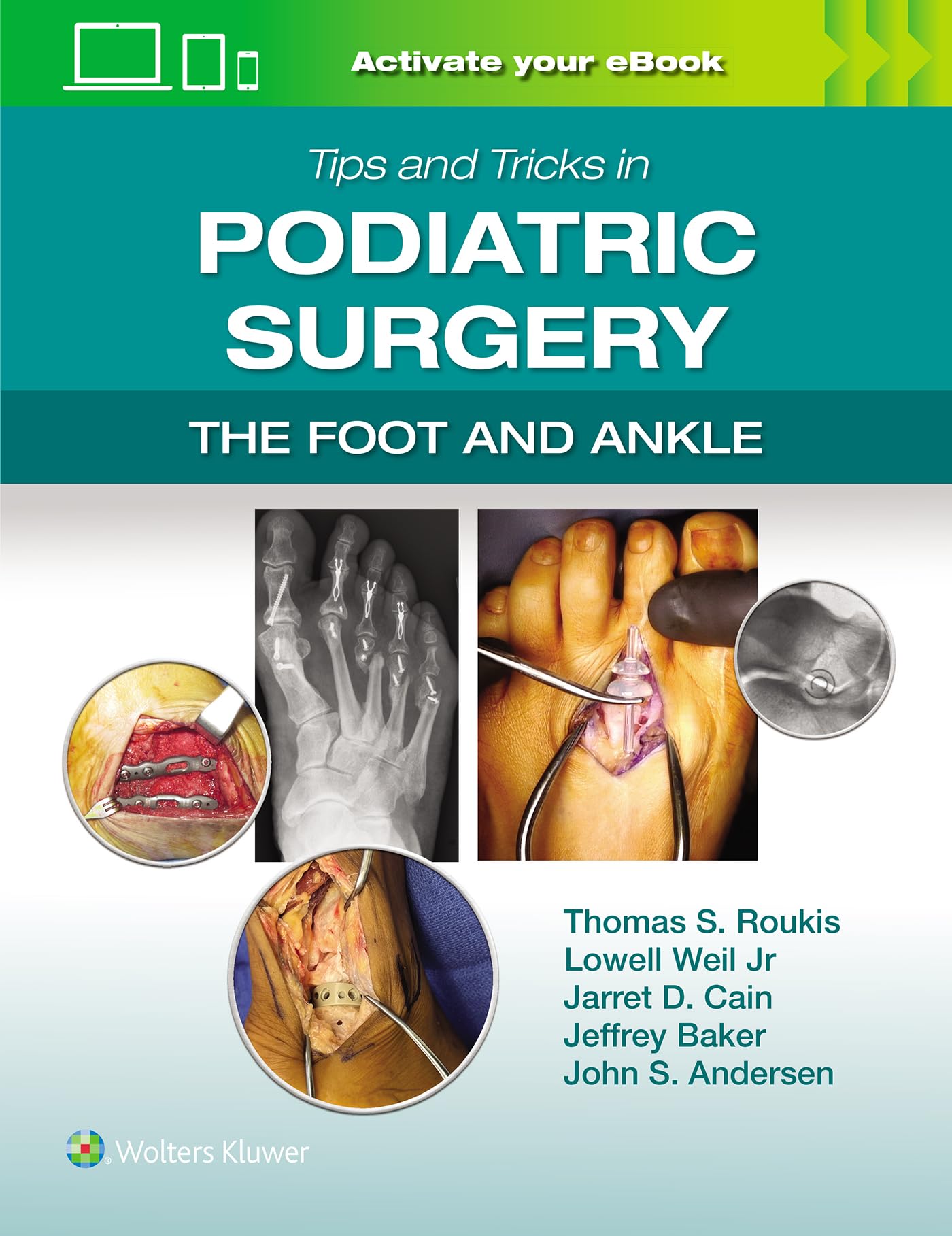 Tips and Tricks in Podiatric Surgery: The Foot and Ankle: Print + eBook with Multimedia: The Foot and Ankle, With Online Files