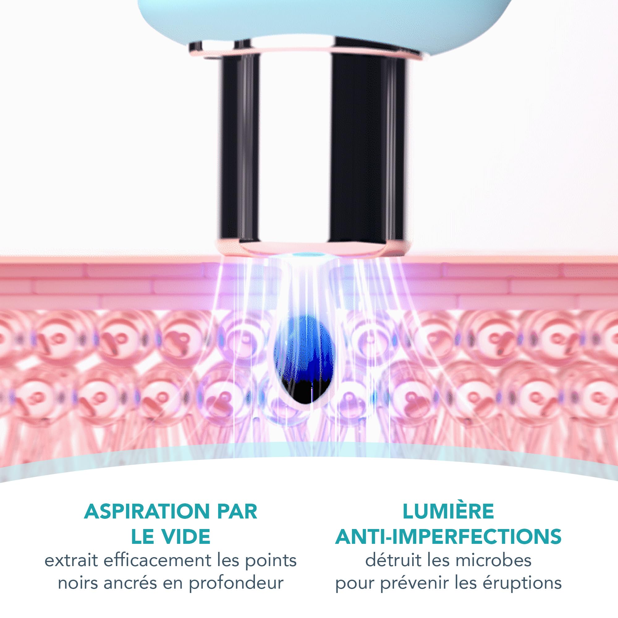 FOREO KIWI Elimina puntos negros + Mascarilla Active Pore 100 g Set | elimina puntos negros, aspirador de poros, extractor, minimiza poros, mascarilla facial, limpiador de poros, comedones